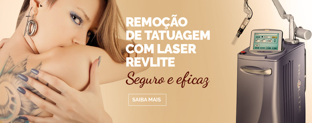 remocao tatuagem