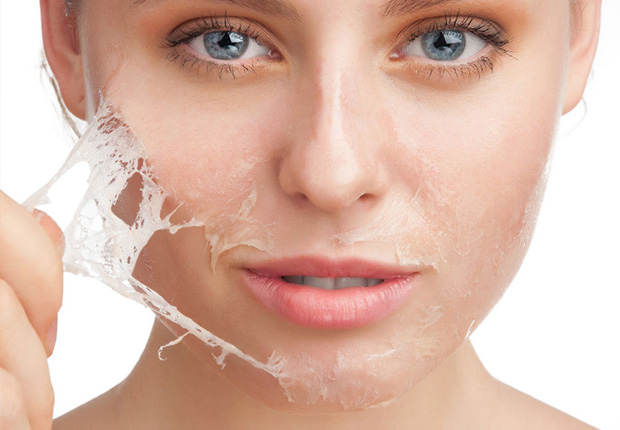peeling